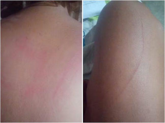 Ilhéus: Garota de programa é estuprada por três homens e pula de carro em movimento para fugir