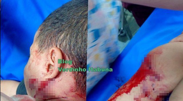 Criança autista de 4 anos é atacada por pitbull em Itabuna