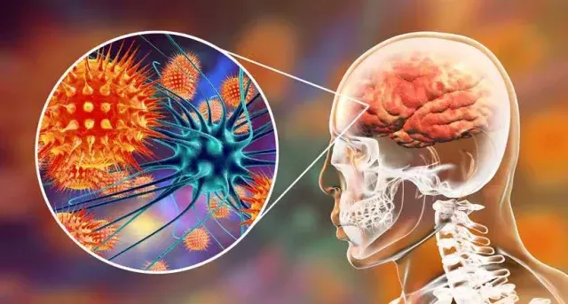 Especialistas afirmam que vírus Nipah preocupa, mas risco de disseminação no Brasil é considerado baixo